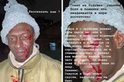 Просил включить радио: в Киеве таксист Bolt избил темнокожего пассажира (Фото) 
